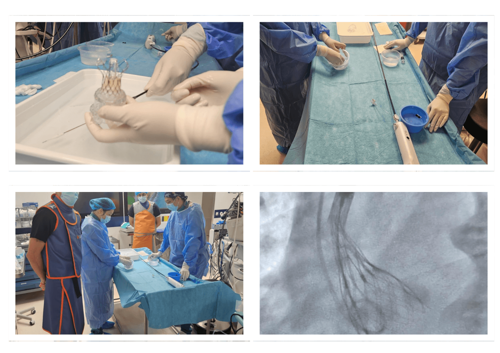 Four photos of the VitaFlow Liberty valve being prepared on the sterile table, and an X-ray image of the delivery system